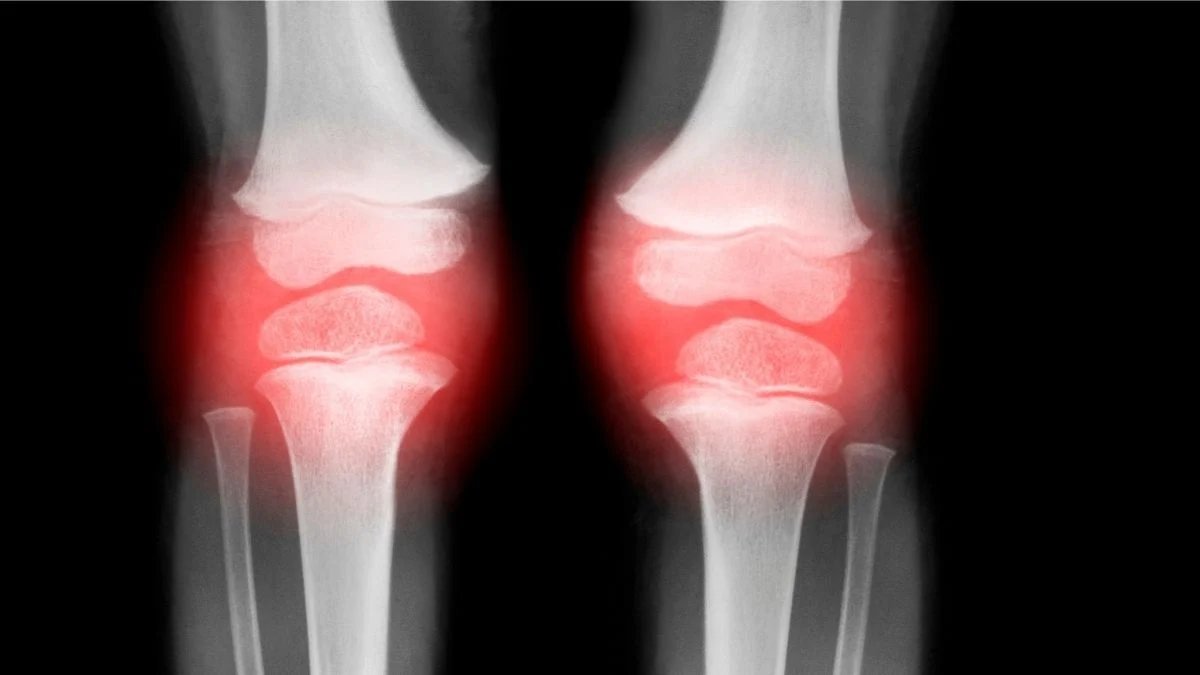 Ölçme cihazları: Bu yenilikçi teknoloji, yaşlanmış eklemlerin yeniden canlandırılmasına yardımcı olabilir ve osteoartrit tedavisinde destek sağlayabilir