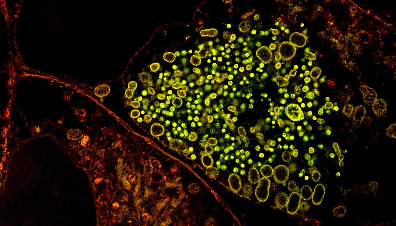 Chlamydia bakterisi DNA’sını lipitlerle paketliyor: Enfeksiyonun önlenmesi için yeni hedef ortaya çıktı