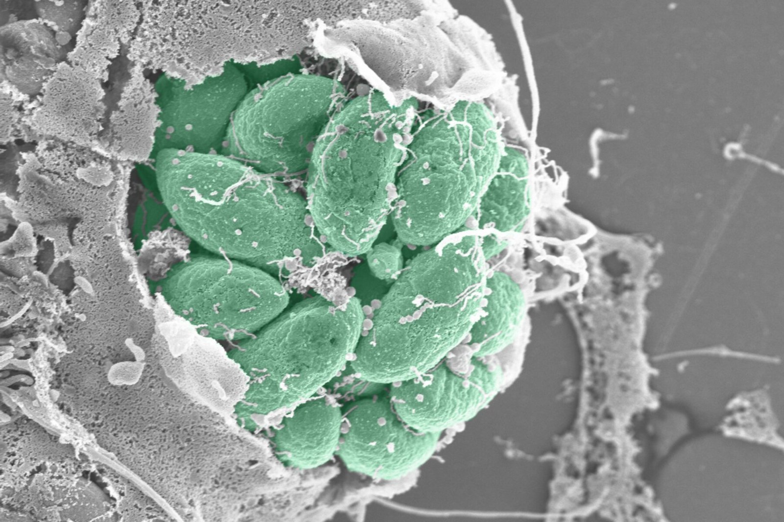 Parazit Hücreyi Nasıl Ele Geçiriyor: Toxoplasma’nın Gizli Saldırı Mekanizması
