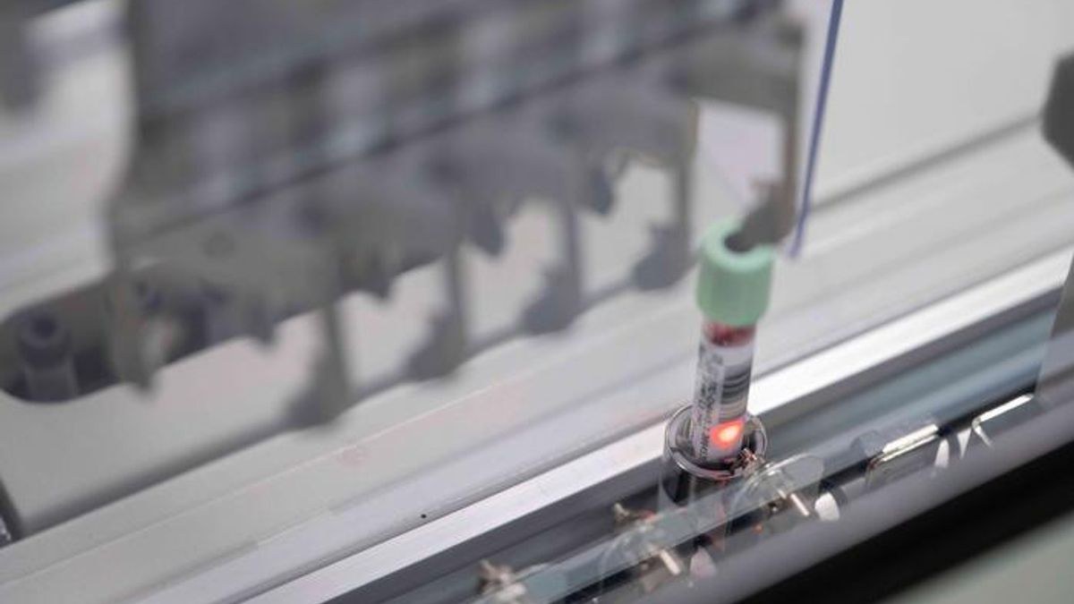 Yeni Kan Testi Pancreas Kansini En Erken Aşamalarda Tespit Edebilir, “Sessiz Katil”e Karşı Umut Verdi